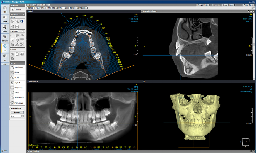 CBCT Evaluation