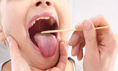 Tonsil & Adenoid Treatment With Coblation